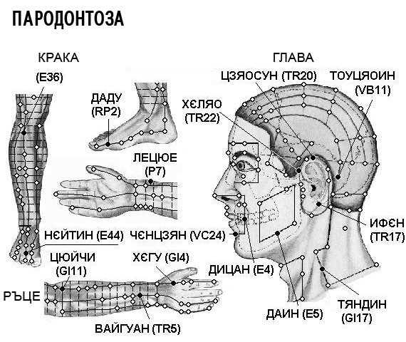 ПАРОДОНТОЗА | ЕЛЕКТРОПУНКТУРА