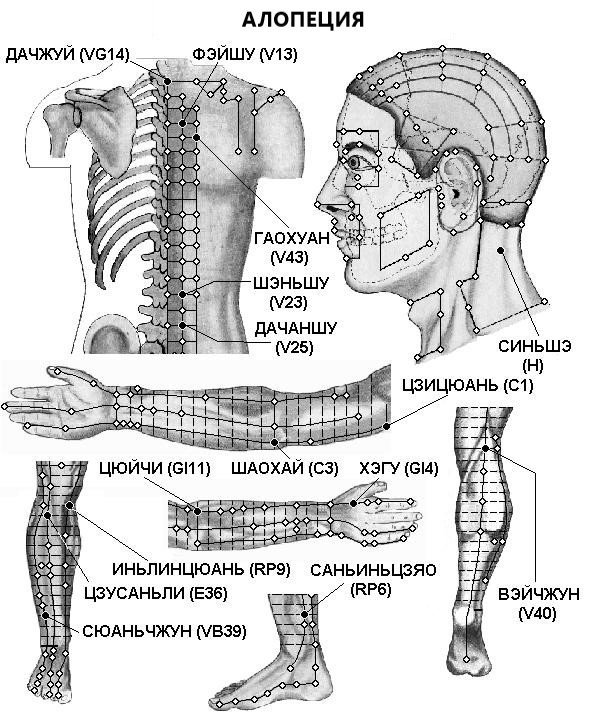 АЛОПЕЦИЯ | ЕЛЕКТРОПУНКТУРА